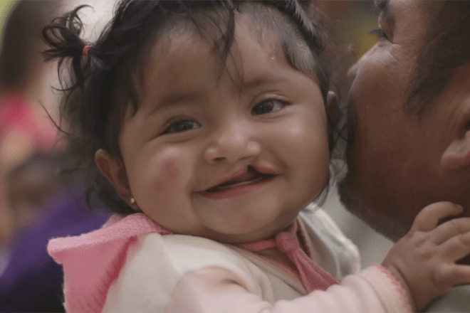 Operation Smile Video